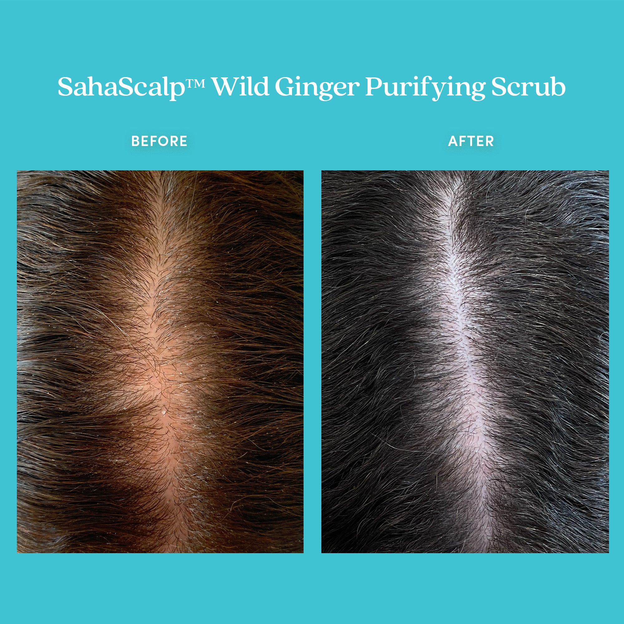 SahaScalp™ Wild Ginger Purifying Scrub